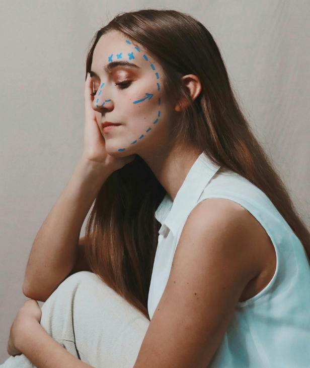 Rhinoplasty